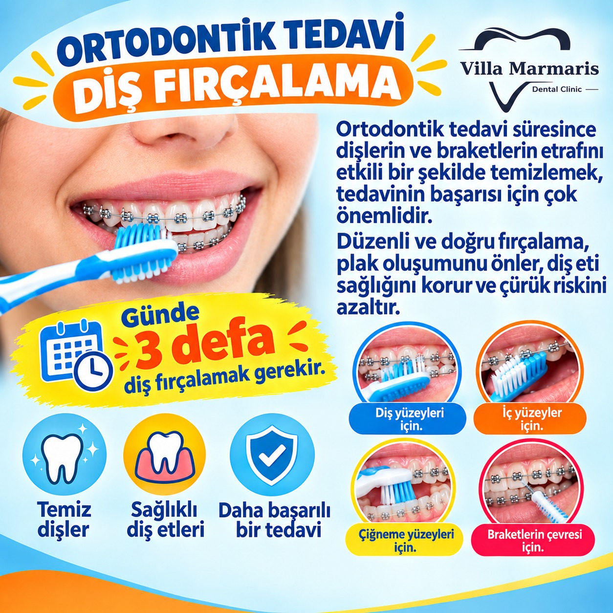 Ortodontik tedavide diş fırçalama