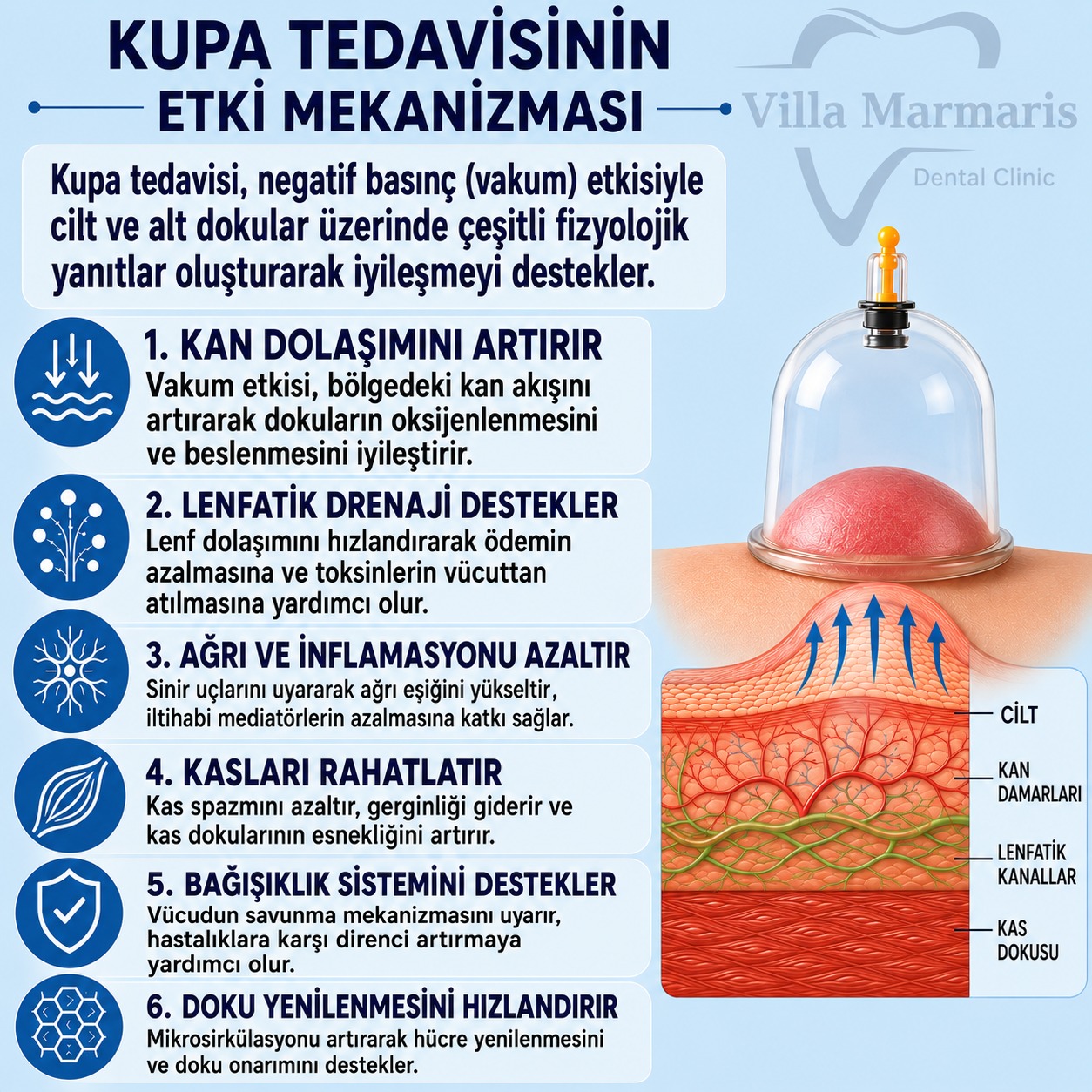 Kupa tedavisinin etki mekanizması